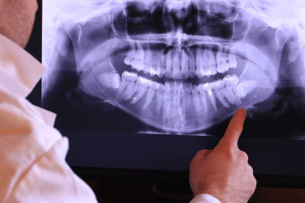 Best Emergency Dentist for Lost Fillings or Crowns in Shoemakersville, PA